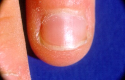 dedo2.jpg (21053 bytes)