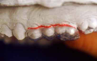 marcas_lateral.jpg (18094 bytes)