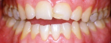 paciente1_frontal.jpg (13757 bytes)