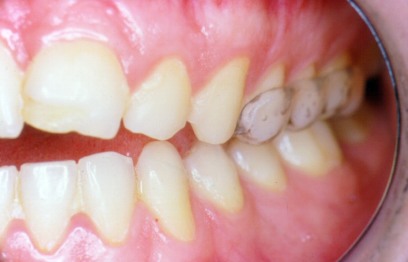 paciente1_lateral.jpg (21875 bytes)